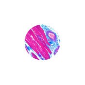 Trichrome Stain Kit